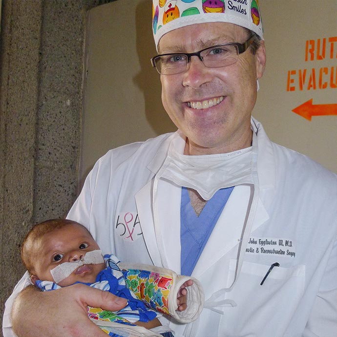 Dr. John Eggleston makes new smiles from a cleft lip with Austin Smiles in San Salvador